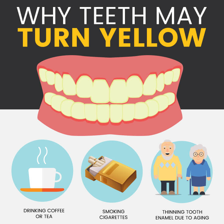 Why Do Teeth Turn Yellow