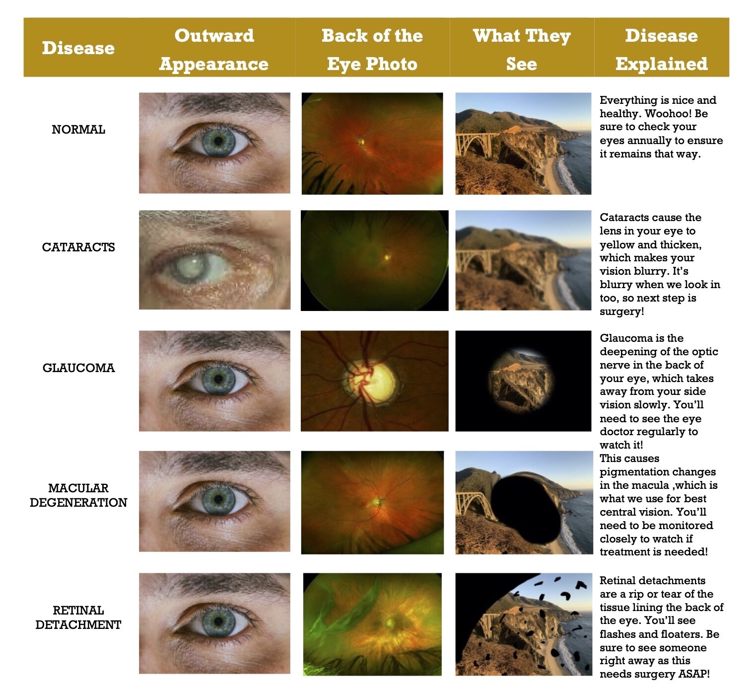 SEEING DISEASE DIFFERENTLY — Spectacle Optometry